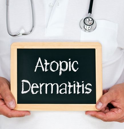 Атопічний дерматит - лікування хвороби