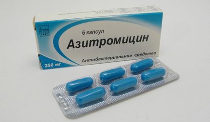 Azithromycin bronchitis (gyermekek és felnőttek) véleménye, a kezelés