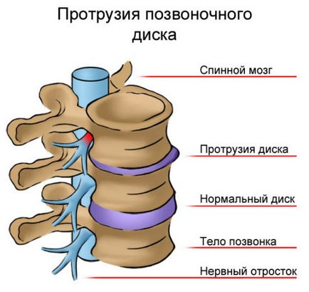 Mi a különbség egy MRI CT, és a jobb a különbség felmérések