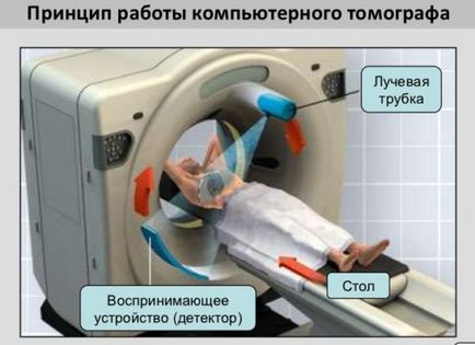 Mi a különbség egy MRI CT, és a jobb a különbség felmérések