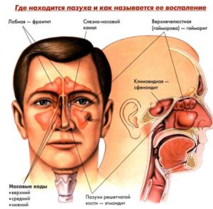 Чим промивати ніс в домашніх умовах розчини і засоби