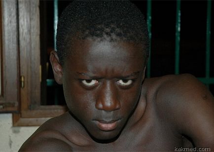 Piele neagră la oameni din Africa