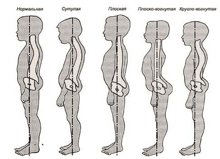 Що таке майстер постави