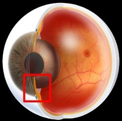 Diagnosticul glaucomului