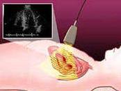 Diagnosticul bolii cardiace congenitale