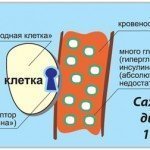 Ендокринна функція підшлункової залози і розвиток цукрового діабету, фото і відео