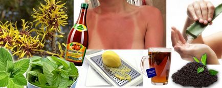 Якщо болить і облазить обгоріла на сонці шкіра, використовуйте ці народні засоби після сонячних
