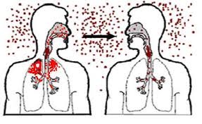 Herpes zoster este contagios sau nu - o caracteristică a problemei