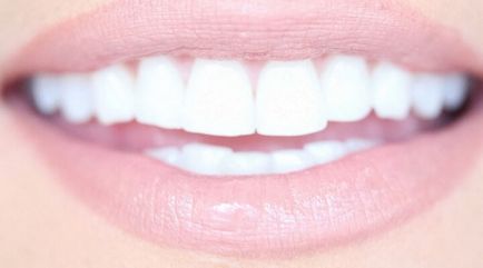 Ідеальна посмішка 4 секрету красивих зубів
