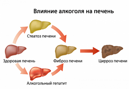 Як болить печінка печінку чи болить і які види болю характерні