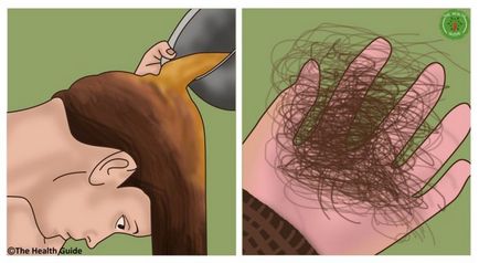 Як припинити випадання волосся відростіть довге волосся швидко і природним способом!