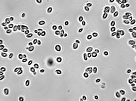 Cum se înmulțesc bacteriile în condiții favorabile și nefavorabile