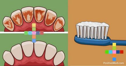 Як видалити зубний камінь, очистити зубний наліт і знищити бактерії за допомогою всього лише