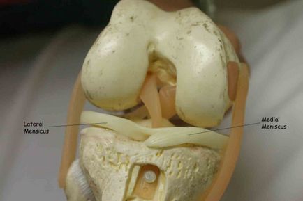 Кіста меніска колінного суглоба - види, симптоми, лікування