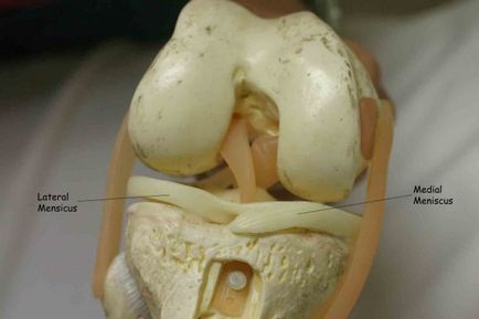 Chistul meniscului articulației genunchiului - tipuri, simptome, tratament