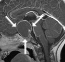 Informații clinice și poliklinik fuer neurosurgie pentru pacienți