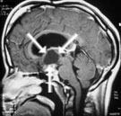 Informații clinice și poliklinik fuer neurosurgie pentru pacienți