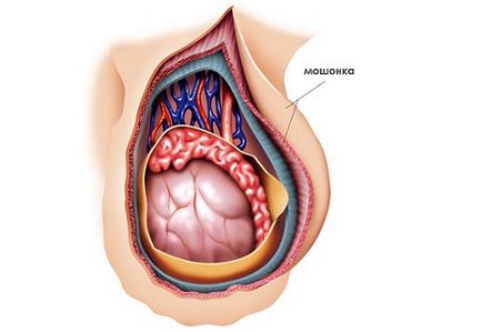 Tratamentul testiculelor cu picături și măsuri pentru prevenirea dezvoltării bolii