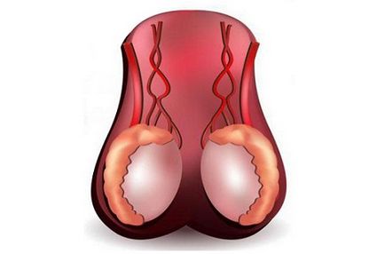 Tratamentul testiculelor cu picături și măsuri pentru prevenirea dezvoltării bolii