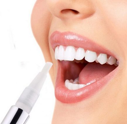 Кращі поради по відбілюванню зубів в домашніх умовах