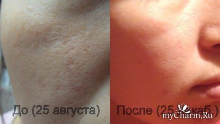 Marokkói agyag a szépség és az egészség a bőr - fitokosmetik marokkói agyag vörös (piros) Marokkói agyag a szépség és az egészség a bőr - fitokosmetik marokkói vörös agyag