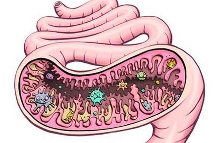 Microflora simptomelor și tratamentului intestinal
