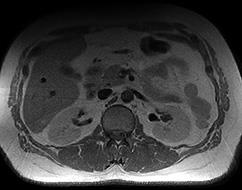 MRI Tuchkovo - diagnosztikai képalkotó központ Tuchkovo