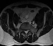 MRI Tuchkovo - diagnosztikai képalkotó központ Tuchkovo