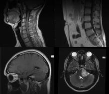 Mrt în cloud - tomografia centrului de diagnosticare în nor