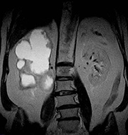 MRI Tuchkovo - diagnosztikai képalkotó központ Tuchkovo