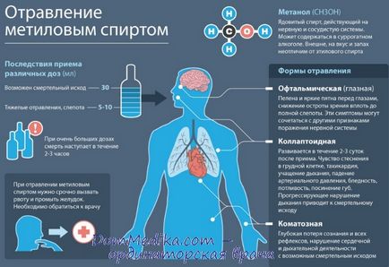 Невідкладна допомога при отруєнні метиловим спиртом - діагностика, лікування