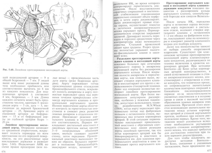 Operații asupra aortei toracice proximale în bolile degenerative