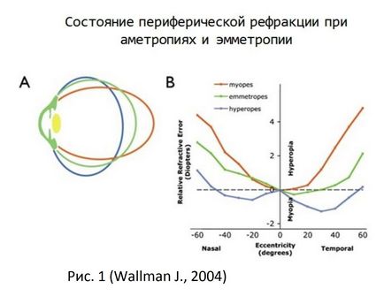 Managementul optic al refractogenezei și homeostaziei ochiului