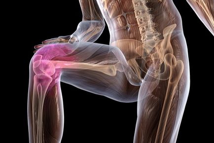Остеопороз колінного, гомілковостопного суглобів і стопи - симптоми і лікування
