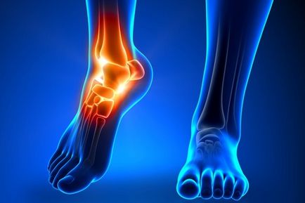 Tratamentul osteoporozei articulației genunchiului
