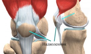 Звичний і вроджений вивих надколінка