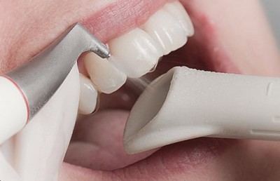 Igiena orală individuală profesională în medicina dentară