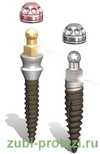 Протезування зубів за допомогою протезів на кулястих замках і імплантатах