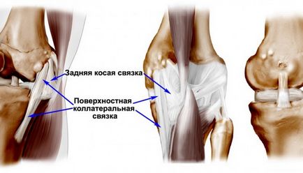 Розтягнення зв'язок колінного суглоба симптоми, лікування, відновлення