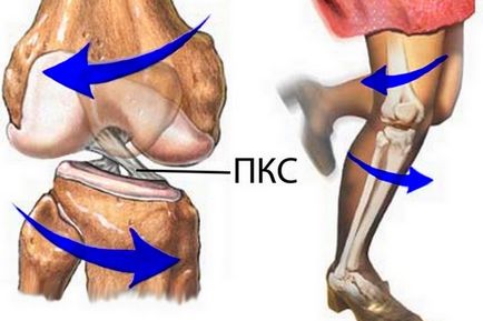 Розтягнення зв'язок колінного суглоба симптоми, лікування, відновлення