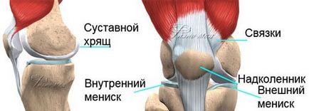 Разкъсан менискус, ние лекуват