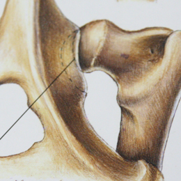 Ruptura ligamentelor