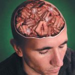 Шизофренія в стадії дебільності інтелект і олігофренія, клінічні форми