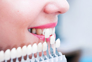 Cât costă pentru a restabili dinții și cum să restabilească