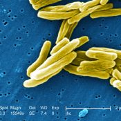 Скільки живе туберкульозна паличка в будинку де жив хворий