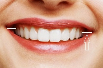 Sfaturi ortodonție - ce trebuie să știți înainte de a vizita un medic