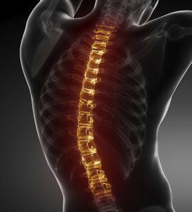 spondylitis a gerinc - a jelek, tünetek és a betegség kezelésében