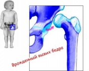 Тератологіческого правило статевого диморфізму Геодакяна