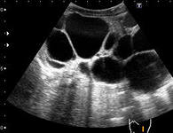 Examinarea cu ultrasunete a rinichilor de câini cu insuficiență renală uzi