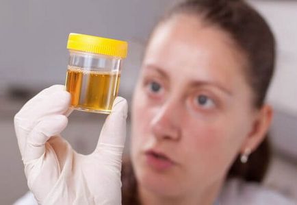 Urina pentru tratamentul venelor varicoase ale extremităților inferioare